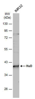 HuD Antibody in Western Blot (WB)