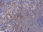 SYNM Antibody in Immunohistochemistry (Paraffin) (IHC (P))