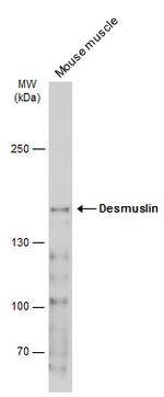 SYNM Antibody in Western Blot (WB)