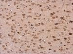 HuC Antibody in Immunohistochemistry (Paraffin) (IHC (P))
