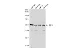 KIF6 Polyclonal Antibody