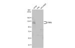 BCL11B Antibody in Western Blot (WB)