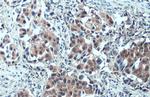 SMCR8 Antibody in Immunohistochemistry (Paraffin) (IHC (P))