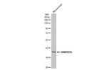 ANKRD16 Polyclonal Antibody