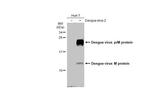 Dengue Virus Type 2 prM Polyclonal Antibody