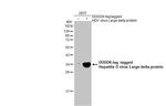 Hepatitis D Virus Large delta Protein Polyclonal Antibody