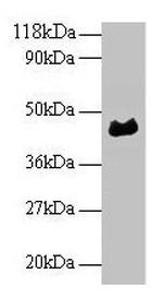 ORM1 Polyclonal Antibody
