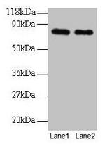 Transferrin Polyclonal Antibody