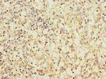 CD1c Polyclonal Antibody