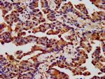 CHRNB3 Antibody in Immunohistochemistry (Paraffin) (IHC (P))