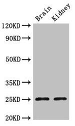 Claudin 10 Antibody in Western Blot (WB)