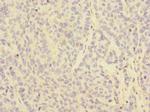CD32c (FCGR2C) Polyclonal Antibody