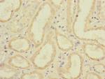 CD32c (FCGR2C) Antibody in Immunohistochemistry (Paraffin) (IHC (P))