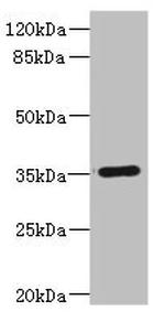 CD32c (FCGR2C) Antibody in Western Blot (WB)