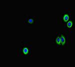 GAA Polyclonal Antibody