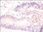 H2AFJ Antibody in Immunohistochemistry (Paraffin) (IHC (P))