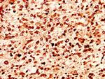 Histone H1.4 Antibody in Immunohistochemistry (Paraffin) (IHC (P))