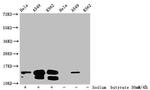 Butyryl-HIST1H2BC (Lys20) Antibody in Western Blot (WB)
