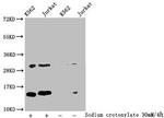 Crotonyl-HIST1H2BC (Lys20) Antibody in Western Blot (WB)