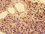 CD25 Antibody in Immunohistochemistry (Paraffin) (IHC (P))