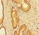 RC74 Antibody in Immunohistochemistry (Paraffin) (IHC (P))