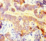 RC74 Antibody in Immunohistochemistry (Paraffin) (IHC (P))