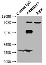 ARHGEF7 Antibody in Immunoprecipitation (IP)