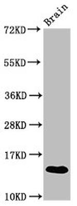 S100A9 Polyclonal Antibody