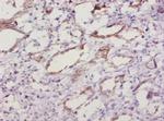 SOD1 Polyclonal Antibody