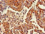 WNT5A Antibody in Immunohistochemistry (Paraffin) (IHC (P))
