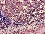WNT5A Antibody in Immunohistochemistry (Paraffin) (IHC (P))
