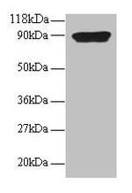 CXCL5 Polyclonal Antibody