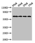 E. coli dgcQ Polyclonal Antibody