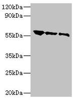 Rabies Virus Glycoprotein Polyclonal Antibody