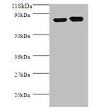 E. coli ldcC Polyclonal Antibody
