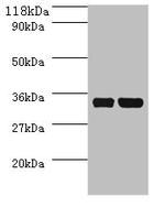 E. coli dcyD Polyclonal Antibody