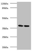 Mycobacterium tuberculosis Ag85A Antibody in Western Blot (WB)