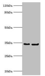 Rabies Virus Phosphoprotein Polyclonal Antibody