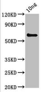 Mycoplasma pneumoniae XPNPEP1 Polyclonal Antibody