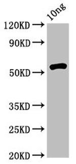 Rhodobacter sphaeroides rsrIM Polyclonal Antibody
