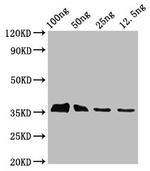 Epstein Barr Virus BLLF3 Polyclonal Antibody