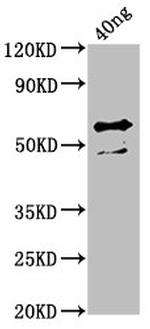 Haemophilus influenzae ompA Polyclonal Antibody