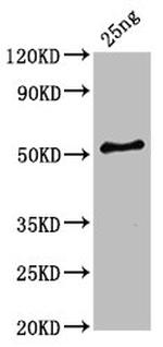 Clostridium botulinum HA-33 Polyclonal Antibody