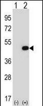 eIF2b gamma Polyclonal Antibody