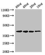 Mycoplasma pneumoniae pepF Antibody in Western Blot (WB)