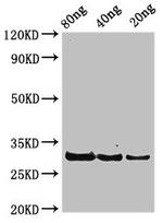 Staphylococcus aureus rplL Polyclonal Antibody