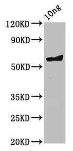 Chlamydia trachomatis serovar L2 ompA Polyclonal Antibody