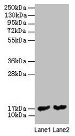 Mycobacterium tuberculosis MPT63 Polyclonal Antibody