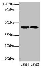 E. coli lapB Polyclonal Antibody