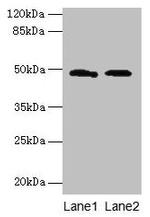 E. coli SurA Polyclonal Antibody